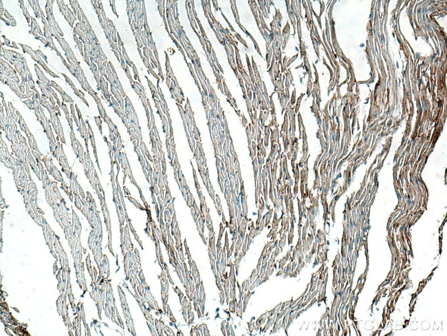 Beta Actin Antibody in Immunohistochemistry (Paraffin) (IHC (P))