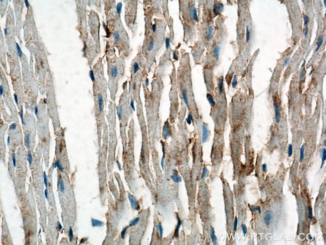 Beta Actin Antibody in Immunohistochemistry (Paraffin) (IHC (P))