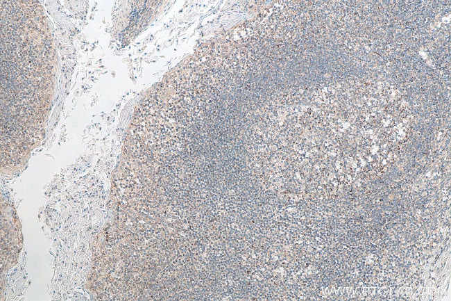 CXCR4 Antibody in Immunohistochemistry (Paraffin) (IHC (P))