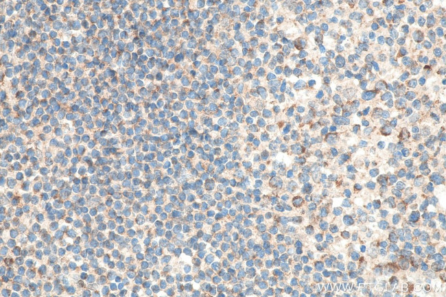 CXCR4 Antibody in Immunohistochemistry (Paraffin) (IHC (P))