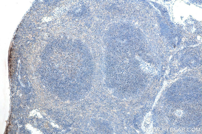 CXCR4 Antibody in Immunohistochemistry (Paraffin) (IHC (P))