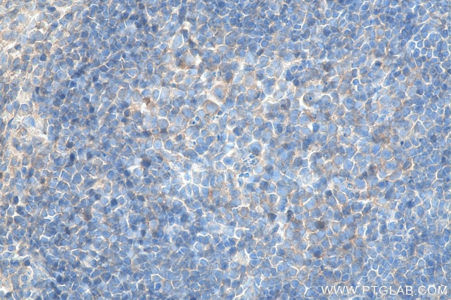 CXCR4 Antibody in Immunohistochemistry (Paraffin) (IHC (P))