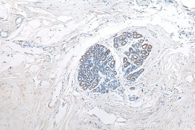 CXCR4 Antibody in Immunohistochemistry (Paraffin) (IHC (P))