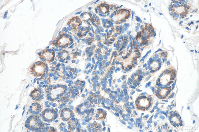 CXCR4 Antibody in Immunohistochemistry (Paraffin) (IHC (P))