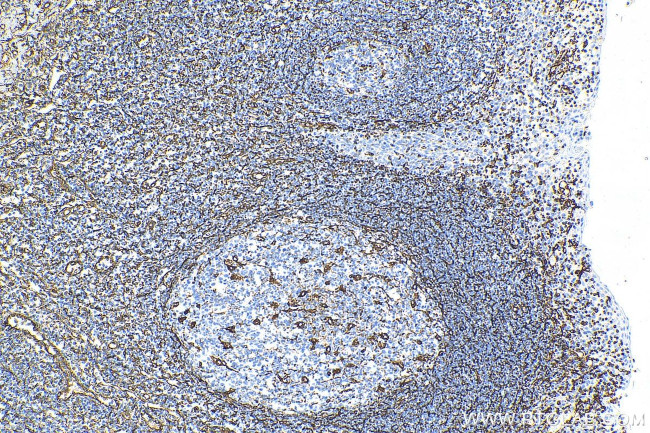 Vimentin Antibody in Immunohistochemistry (Paraffin) (IHC (P))