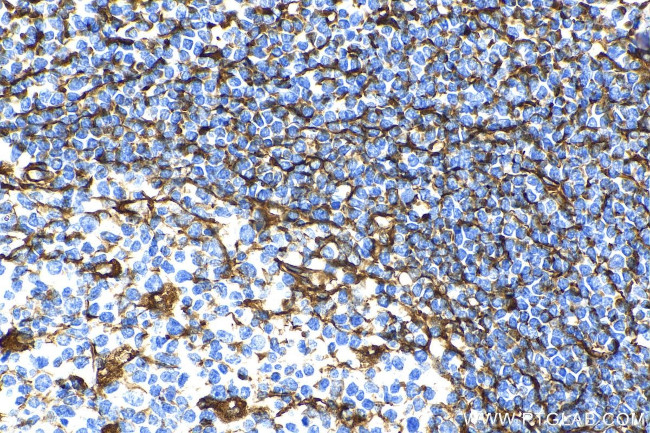 Vimentin Antibody in Immunohistochemistry (Paraffin) (IHC (P))