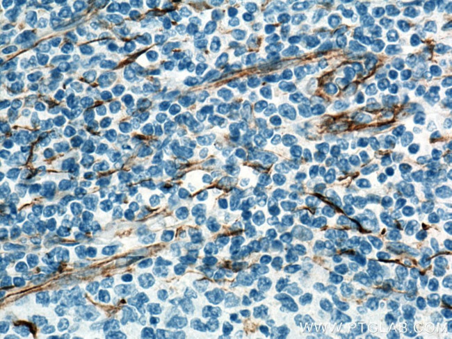 Vimentin Antibody in Immunohistochemistry (Paraffin) (IHC (P))