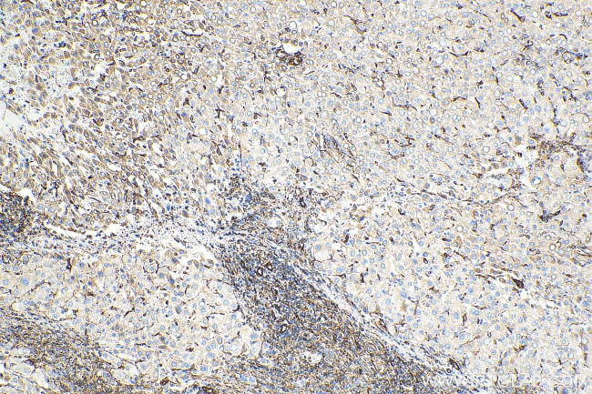 Vimentin Antibody in Immunohistochemistry (Paraffin) (IHC (P))