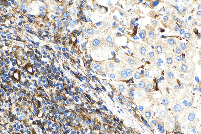 Vimentin Antibody in Immunohistochemistry (Paraffin) (IHC (P))