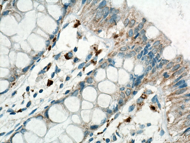 MICA/MICB Antibody in Immunohistochemistry (Paraffin) (IHC (P))