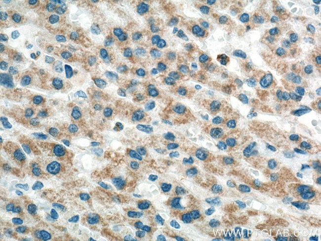 Alpha Tubulin Antibody in Immunohistochemistry (Paraffin) (IHC (P))