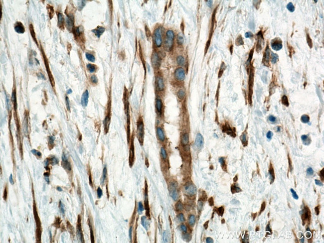 Alpha Tubulin Antibody in Immunohistochemistry (Paraffin) (IHC (P))