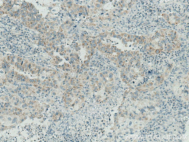 Cytokeratin 7 Antibody in Immunohistochemistry (Paraffin) (IHC (P))