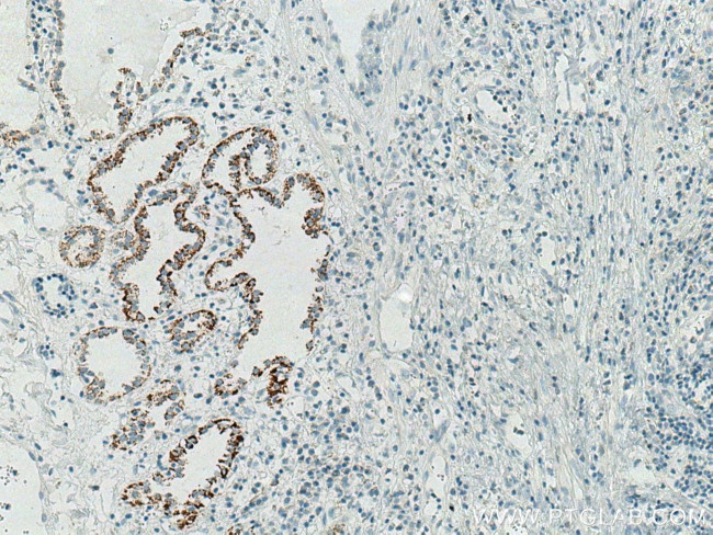 Cytokeratin 7 Antibody in Immunohistochemistry (Paraffin) (IHC (P))