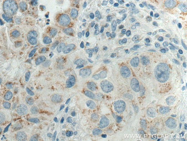 Cytokeratin 7 Antibody in Immunohistochemistry (Paraffin) (IHC (P))