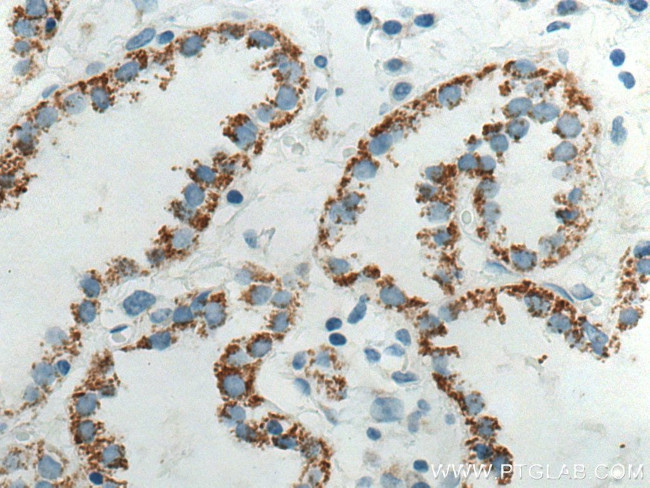 Cytokeratin 7 Antibody in Immunohistochemistry (Paraffin) (IHC (P))