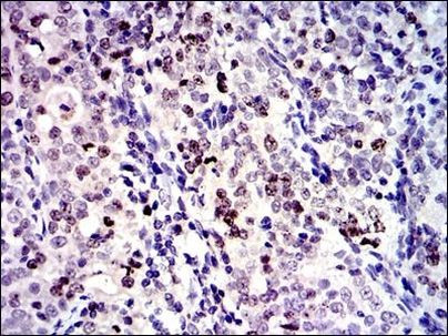 Survivin Antibody in Immunohistochemistry (Paraffin) (IHC (P))