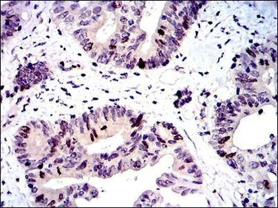 Survivin Antibody in Immunohistochemistry (Paraffin) (IHC (P))