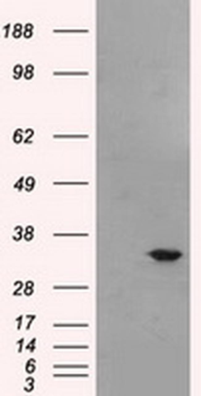 BIRC7 Antibody in Western Blot (WB)