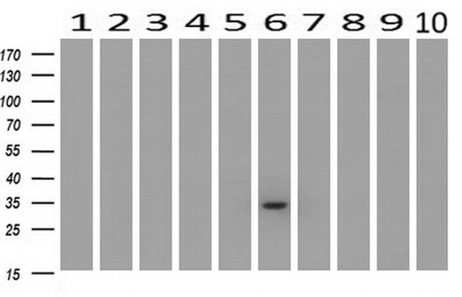 BIRC7 Antibody in Western Blot (WB)