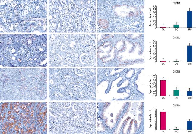 Claudin 3 Antibody in Immunohistochemistry (IHC)