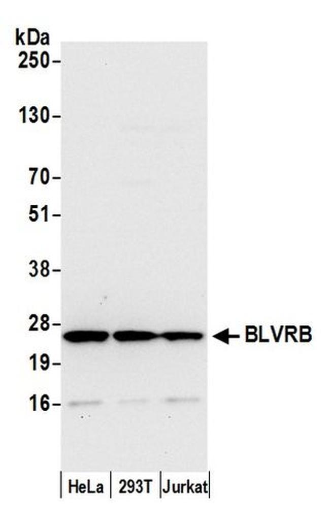 BLVRB/Biliverdin reductase B Antibody in Western Blot (WB)