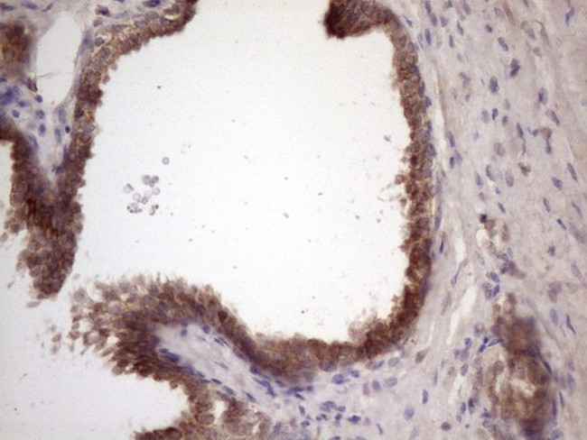 BMF Antibody in Immunohistochemistry (Paraffin) (IHC (P))