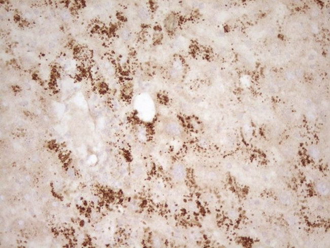 BMF Antibody in Immunohistochemistry (Paraffin) (IHC (P))