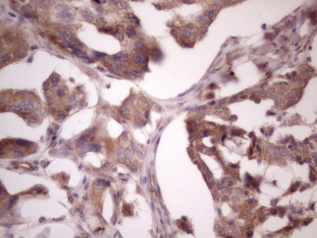 BMF Antibody in Immunohistochemistry (Paraffin) (IHC (P))