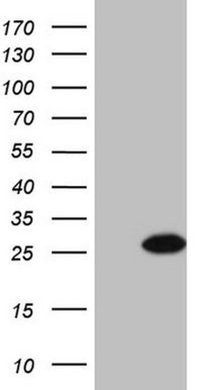 BMF Antibody in Western Blot (WB)