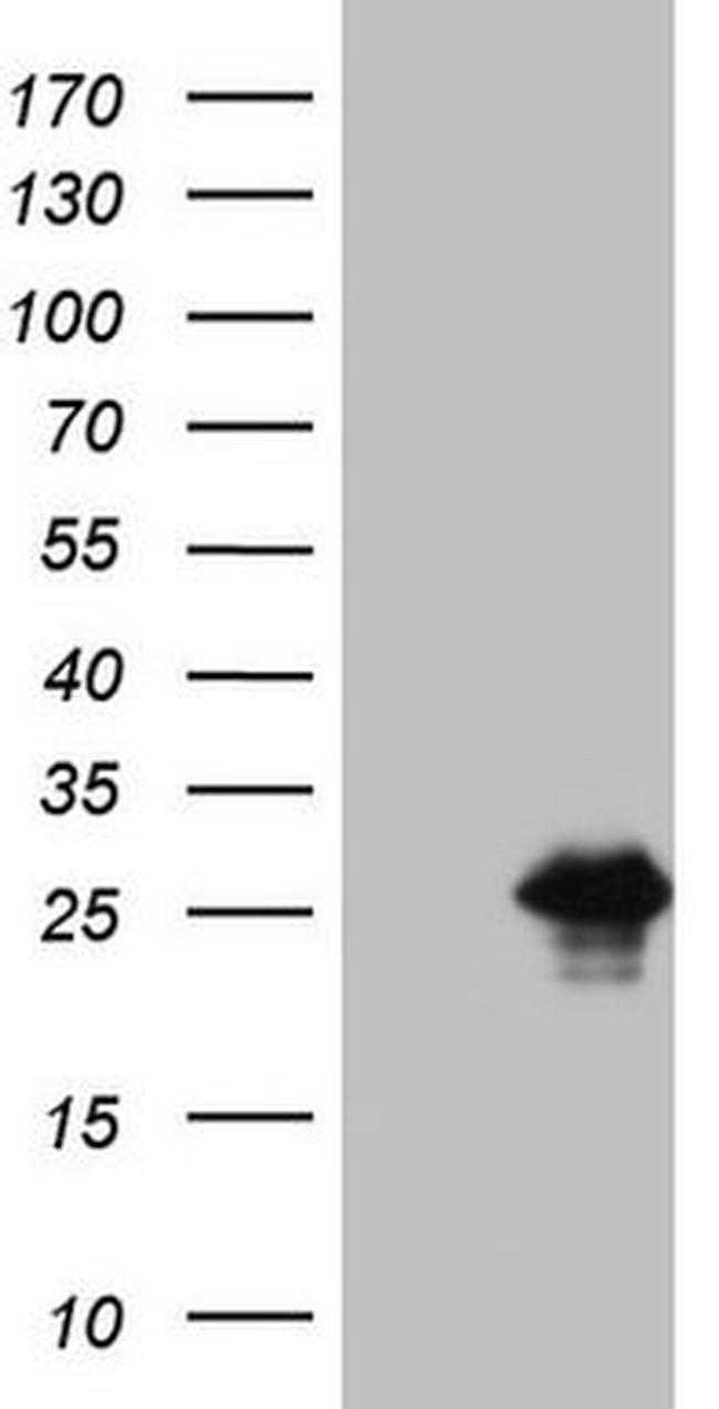 BMF Antibody in Western Blot (WB)