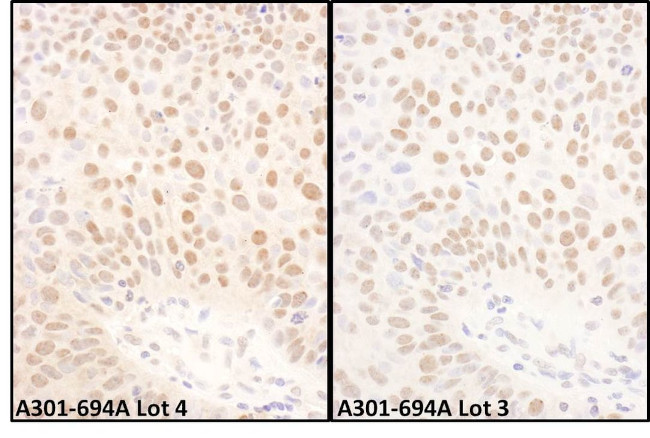 BMI1 Antibody in Immunohistochemistry (IHC)