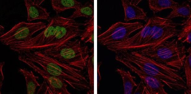 BMI-1 Antibody in Immunocytochemistry (ICC/IF)