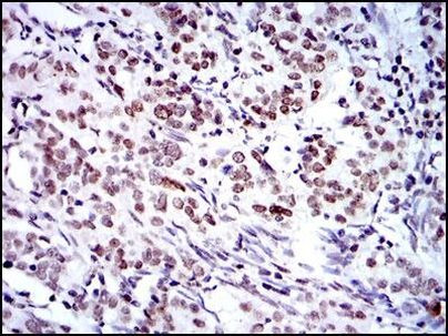 BMI-1 Antibody in Immunohistochemistry (Paraffin) (IHC (P))