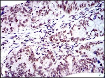 BMI-1 Antibody in Immunohistochemistry (Paraffin) (IHC (P))