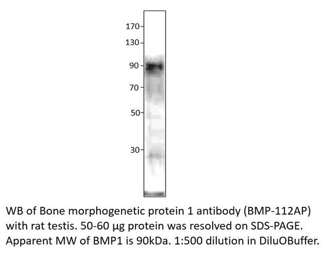 BMP1 Antibody in Western Blot (WB)