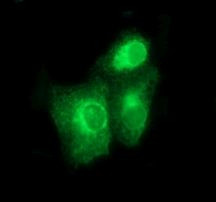 BMP1 Antibody in Immunocytochemistry (ICC/IF)