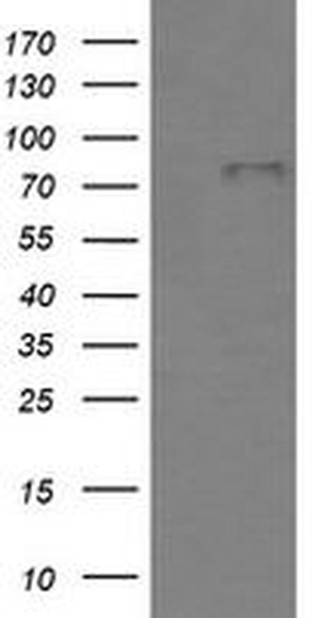 BMP1 Antibody in Western Blot (WB)