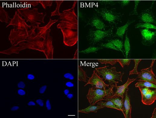 BMP4 Antibody in Immunocytochemistry (ICC/IF)