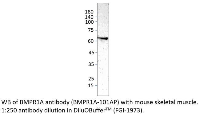 BMPR1A Antibody in Western Blot (WB)