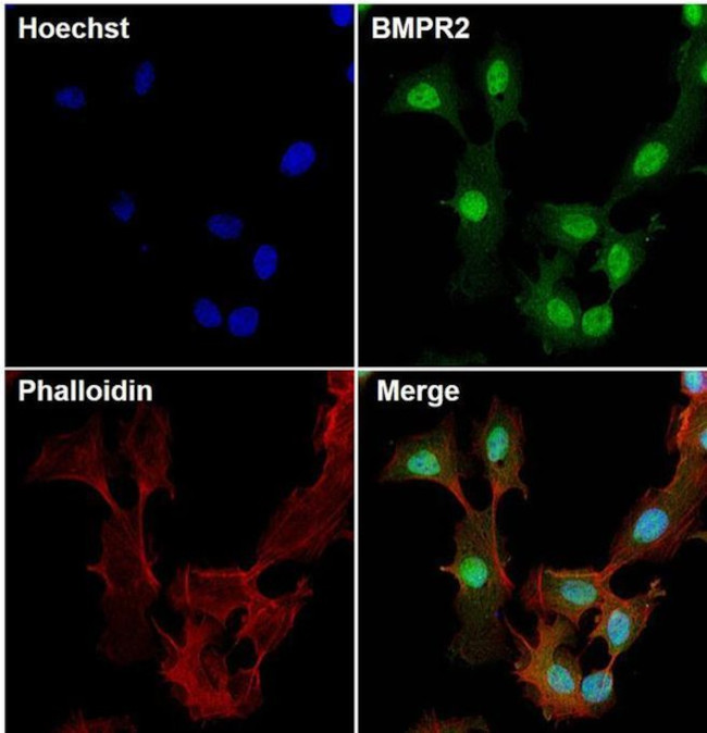 BMPR2 Antibody in Immunocytochemistry (ICC/IF)