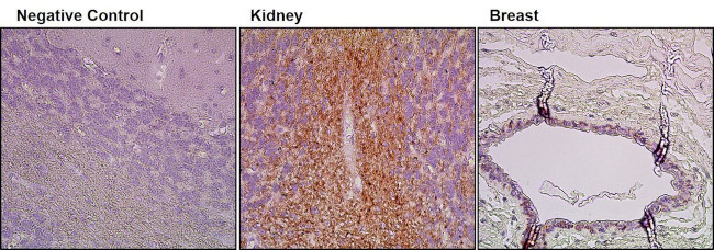 BMPR2 Antibody in Immunohistochemistry (Paraffin) (IHC (P))