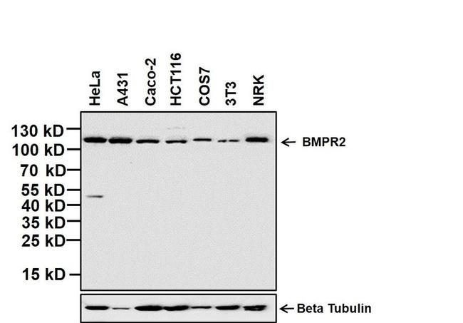 BMPR2 Antibody in Western Blot (WB)