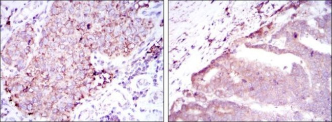 BMPR2 Antibody in Immunohistochemistry (Paraffin) (IHC (P))