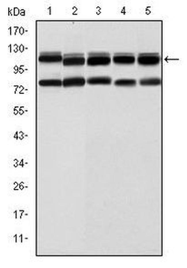 BMPR2 Antibody in Western Blot (WB)