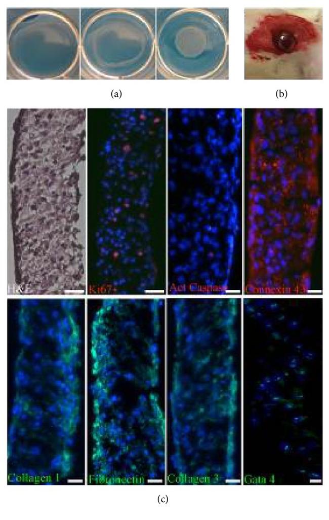 GATA4 Antibody in Immunohistochemistry (IHC)