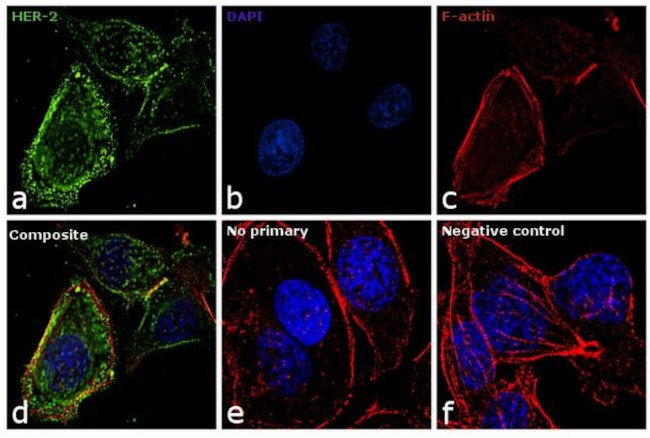 ErbB2 (HER-2) Antibody