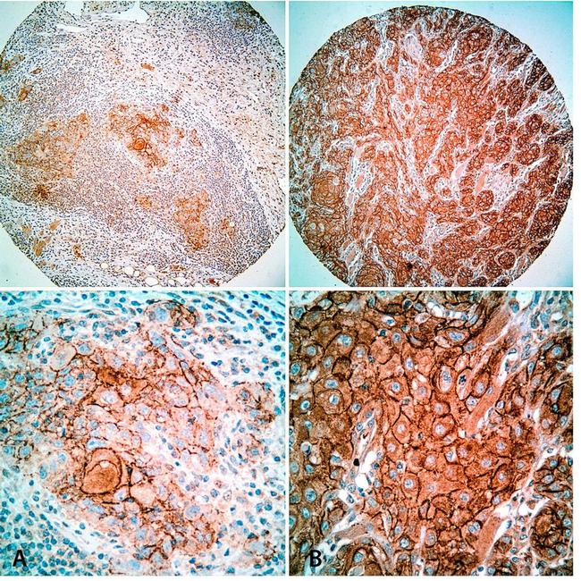 CD44var (v3-v10) Antibody in Immunohistochemistry (IHC)