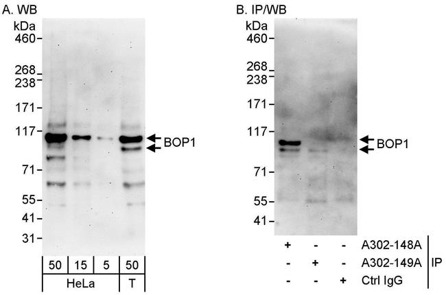 BOP1 Antibody in Western Blot (WB)