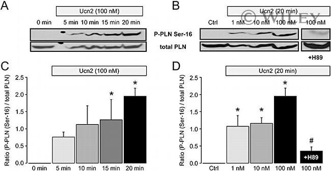 Phospholamban Antibody in Western Blot (WB)